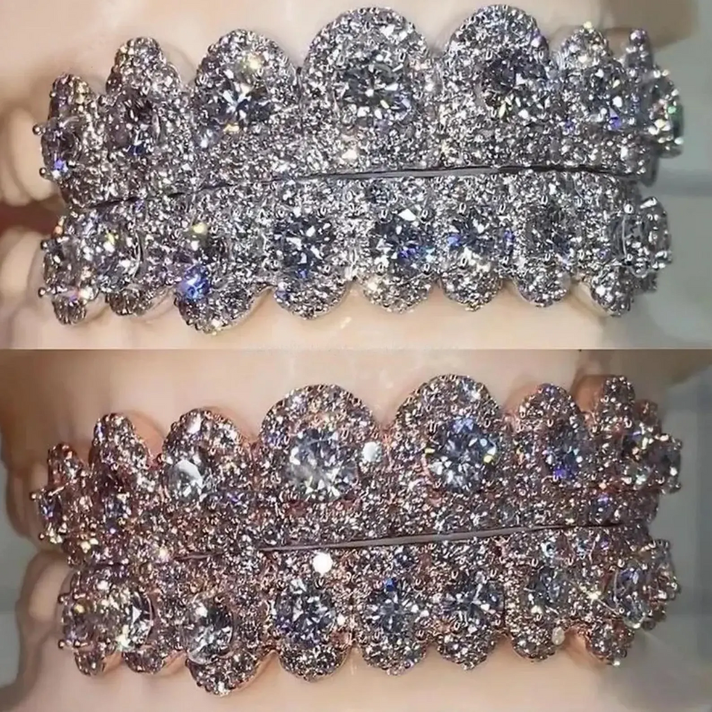 Custom Honeycomb Braces S925 Sterling Silver VVS Moissanite Grillz