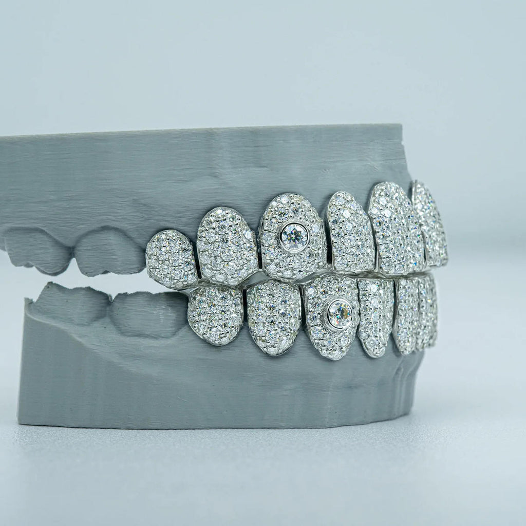10 on 10 Featured inlay S925  VSS Moissanite Diamond Grillz