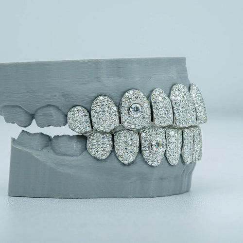 10 on 10 Featured inlay S925  VSS Moissanite Diamond Grillz