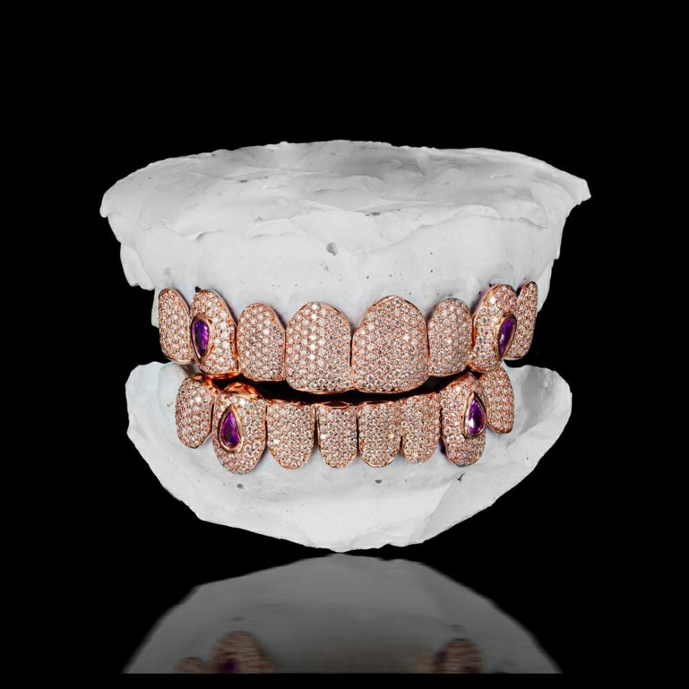 Opal Moissanite Dental Honeycomb Inlay Grillz