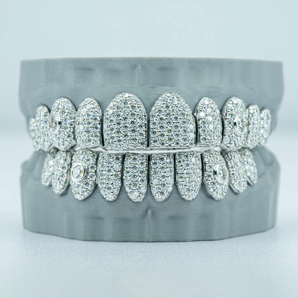 10 on 10 Featured inlay S925  VSS Moissanite Diamond Grillz
