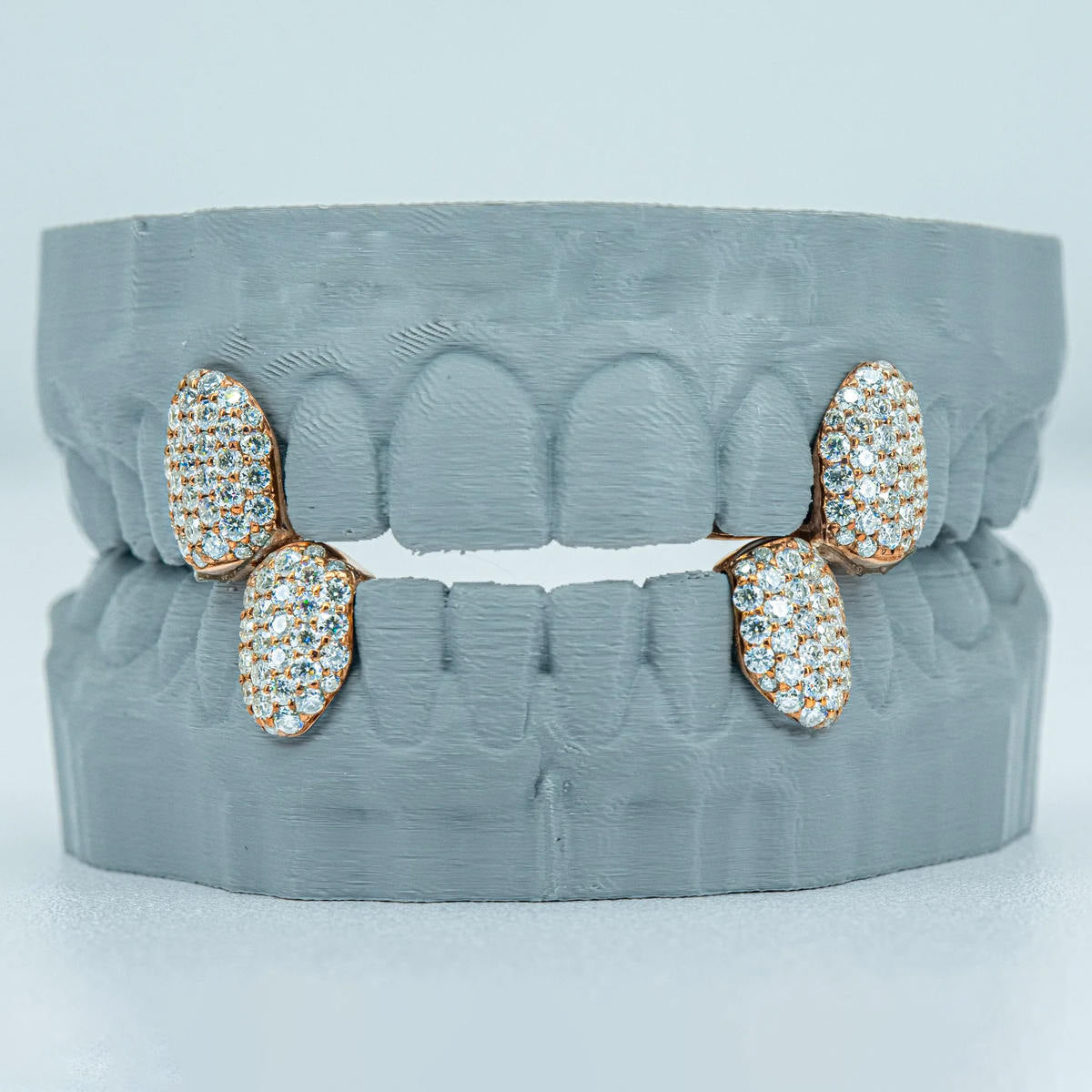 Tiger Teeth S925 Moissanite Diamond Grillz Gubanlink
