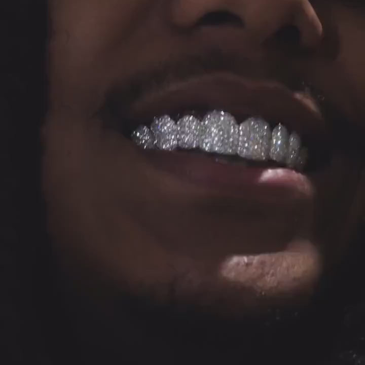 925 Sterling Silver VVS  Moissanite Stones Iced Out  Grillz