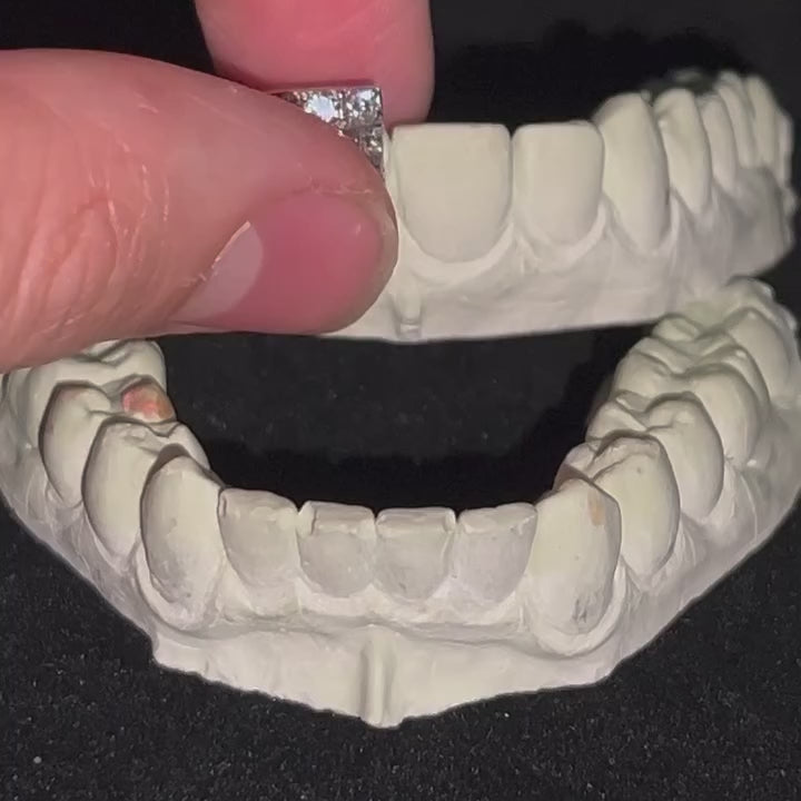10 on 10 Hybrid 10k White Gold Moissanite Diamond Grillz